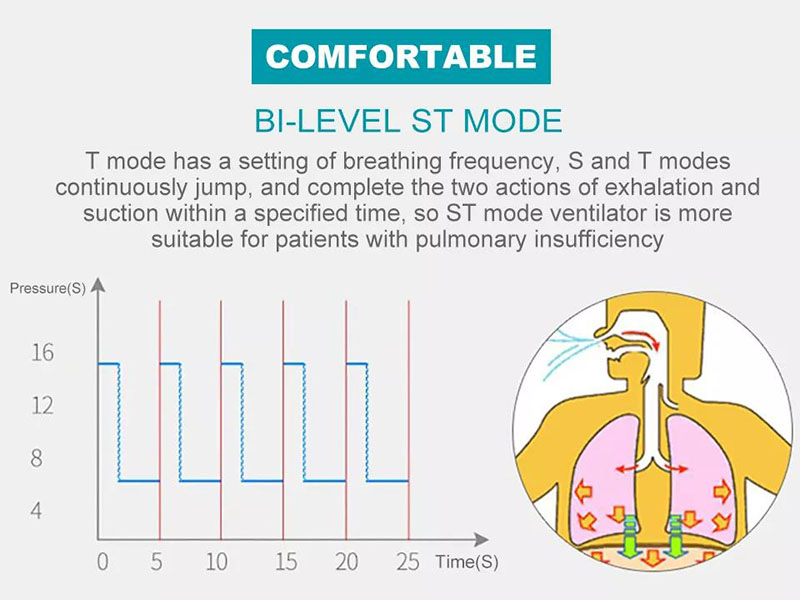 BiPAP Machine For Sleep Apnea