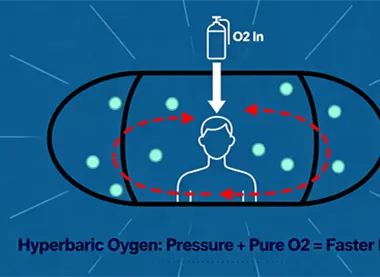How Does a Hyperbaric Oxygen Chamber Work?