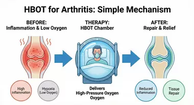 HBOT for Arthritis: The Mechanics of Inflammation Reduction & Equipment Standards